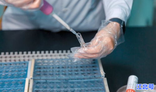 上海市民做核酸检测免费吗现在 核酸检测hiv有没有意义