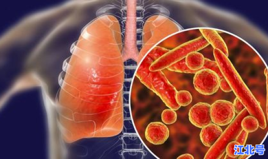 新冠肺炎疫情第二波爆发的原因，新型肺炎疫情