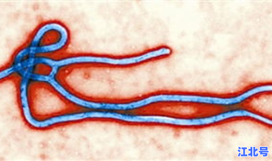 最新出现病毒(埃博拉病毒)