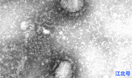 2021年新型冠状病毒情况，2019新型冠状病毒