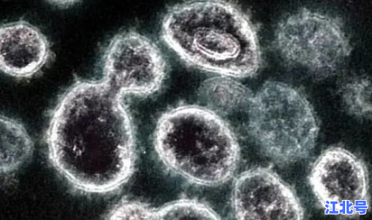 重庆新冠肺炎现状？病毒性肺炎死亡率