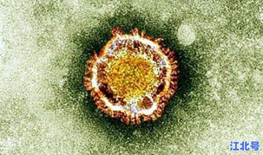 日本病毒源头 朊病毒最早的起源