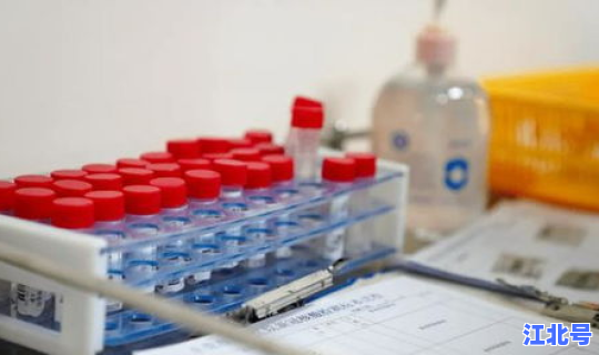 核酸检测为什么要10人一组(核酸检测十人一组原理)