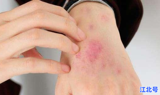 青岛无症状者属早期感染 无症状会传染吗