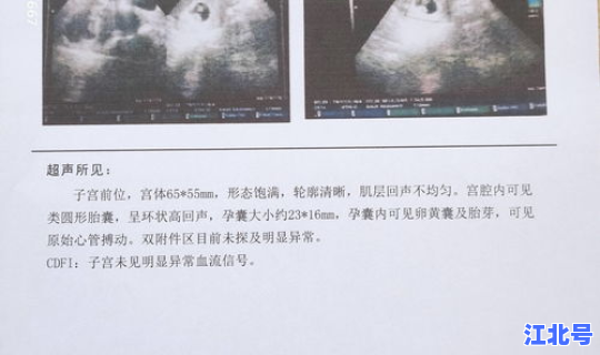 天津近期确诊病例？天津病例单子图片