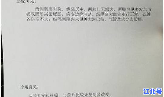 宁波鼓楼确诊病例详情(宁波鼓楼医院中医张)