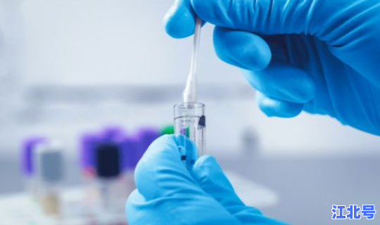 南京核酸检测完成多少小时，核酸检测为什么不能排除hiv