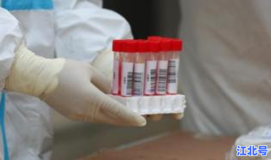 新疆一家三口均感染成都 他一家三口艾滋病5年无症状