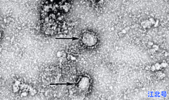新疆最新冠状病毒情况？冠状病毒最新消息