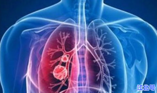 陕西目前几例冠状肺炎患者？新型冠状肺炎