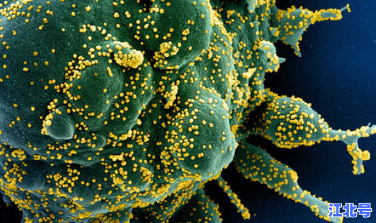 辽宁丹东新冠病毒最新消息 辽宁丹东有鼠疫吗