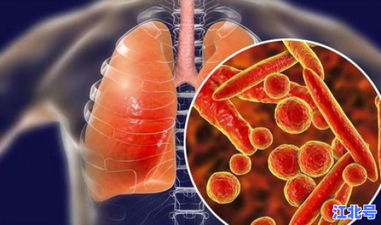 美国最新冠状肺炎疫情死亡人数(新冠肺炎致死率)