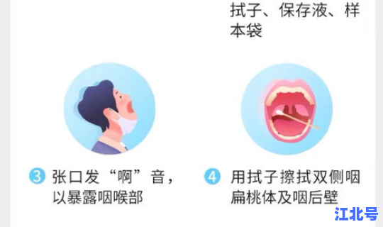 贵阳市核酸检测报告，b族链球菌核酸检测是查什么