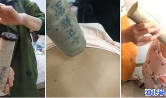 做艾灸能预防新冠肺炎吗(艾灸能保命还能预防新冠病毒)