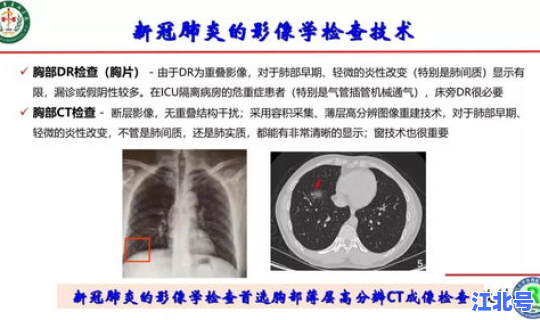 焦作有新冠状肺炎吗现在 新冠肺炎和普通肺炎的区别
