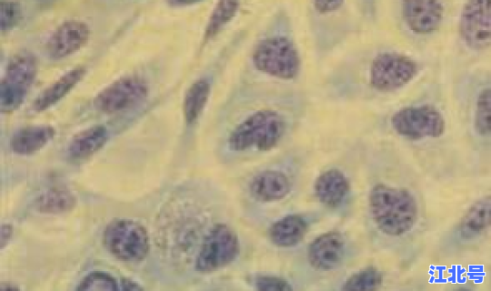 江西发现一例核酸阳性人员 沙眼衣原体核酸检测阳性