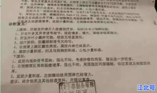 混检可以打印结果吗？无创报告单丢失还能打印吗