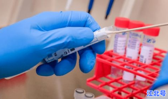 核酸日期改了能看出来吗，核酸检测试纸过期了还能测准吗