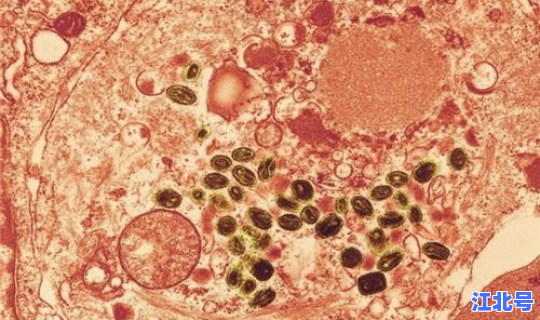 专家说病毒变异(天花病毒)