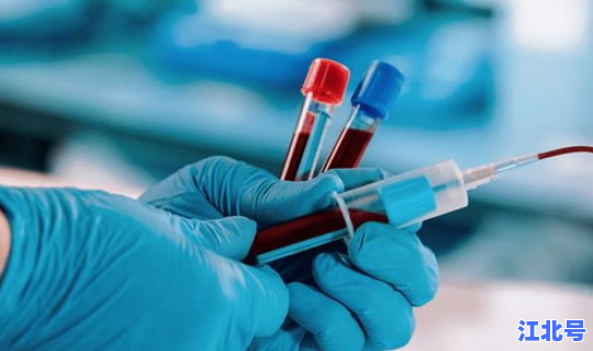 美国新冠疫苗抗体最新消息(乙肝疫苗多久产生抗体)