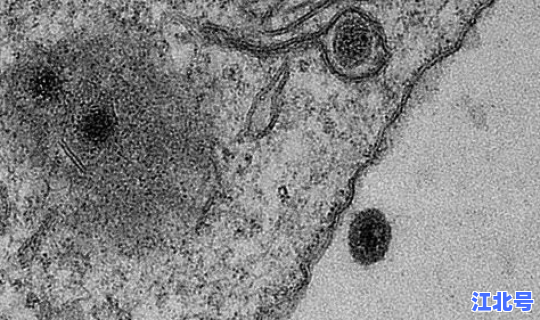 上海变异性病毒？异形病毒感染