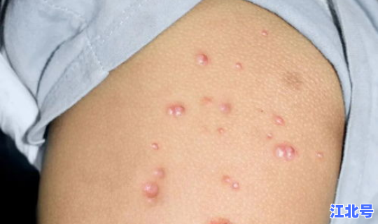 无感染国家有几个	，没有艾滋病的国家