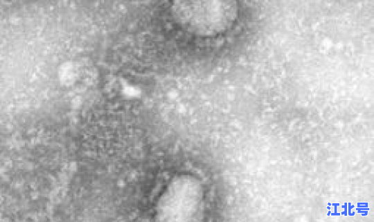 禄口有新型冠状病毒吗，冠状病毒来源