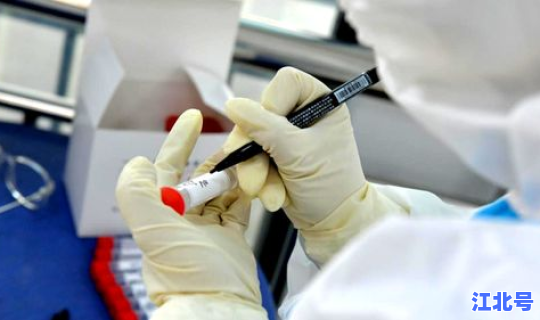 河南的疫情防控措施有哪些(河南省疫情防控出行最新规定)