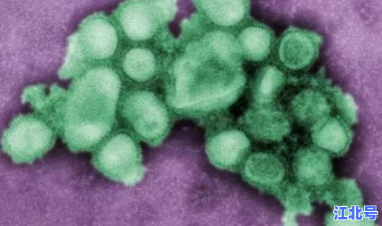 江苏病毒严重吗(病毒就是流感吗) 江苏病毒严重吗(病毒就是流感吗)
