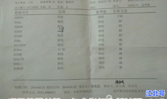郑州现有确诊病例 最近郑州流行的病毒