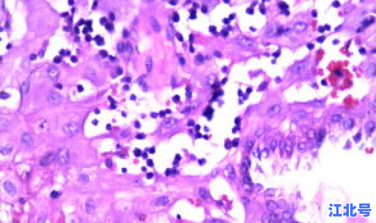 现在江苏出省要做核酸检测吗 hpv核酸检测多久出结果