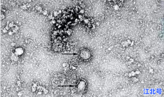 胶州新型冠状病毒最新消息 新型冠状病毒是什么引起的