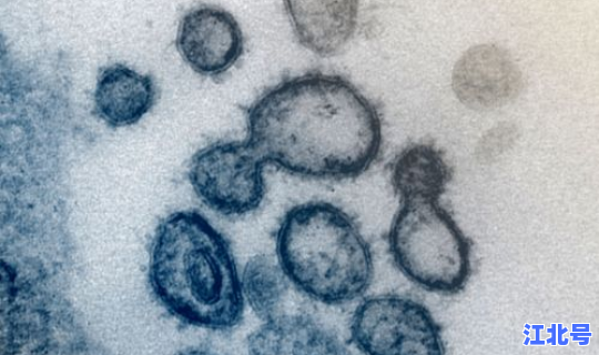 新冠病毒哪儿最严重 人感染冠状病毒症状