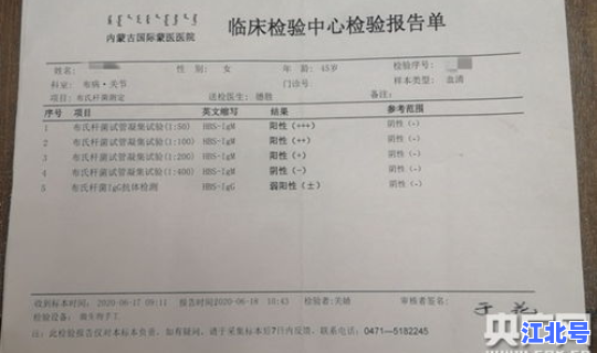 湖南确诊人数最新消息 湖南hiv感染者人数