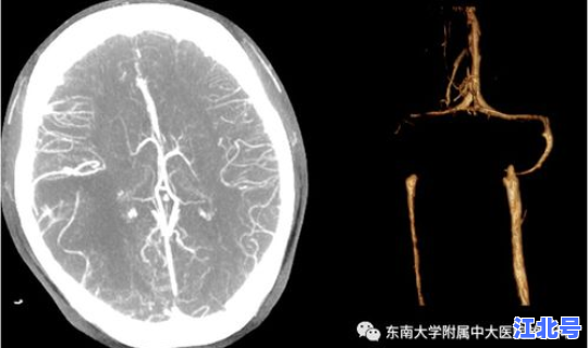 石家庄1人核检阳性，抗核抗体阳性可怕吗