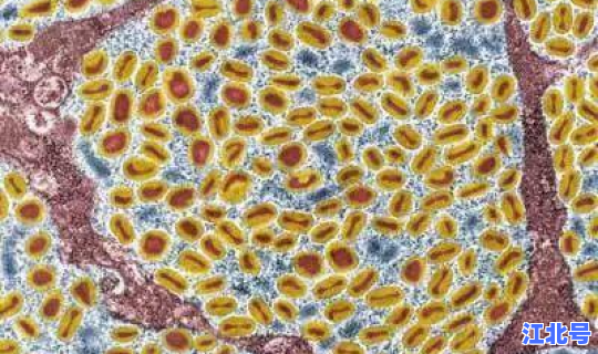 现在还有天花这种病吗(以前的天花病是什么病)