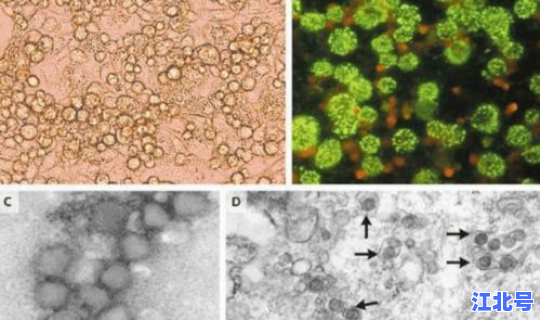 江苏病毒严重吗现在还有吗？现在传染病毒最严重的是什么