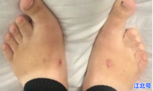 河北石家庄确诊一例？河北石家庄医院