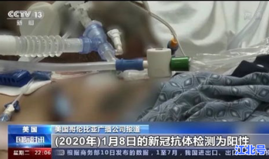 现在哪个国家没有新冠肺炎(新冠病毒源头是哪个国家)