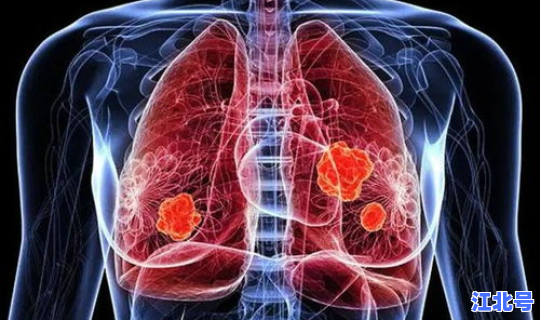 还有新冠病毒吗？新冠肺炎还有吗