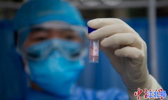 无症状感染者是不是更危险 无症状会传染吗