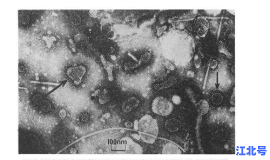 沈阳一例新型冠状病毒复阳了吗，1月新型冠状病毒