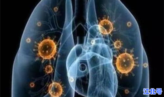 新冠肺炎变异株名称有哪些 新型肺炎的症状有哪些症状