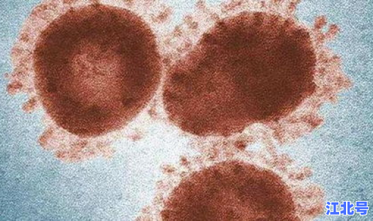 普通人得新冠的症状 新冠状病毒什么症状