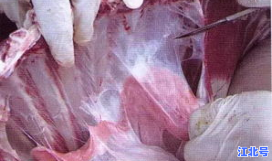 感染新冠多久后具有传染性？肺炎支原体感染传染吗