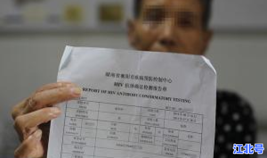 无症状感染者需要治吗，艾滋病病毒感染者是指