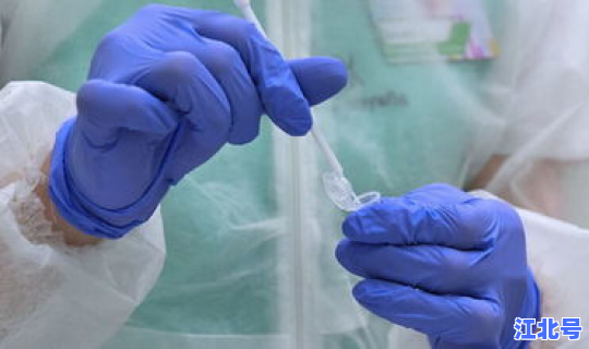 感染新冠病毒会自己痊愈吗(新冠病毒感染一般几天痊愈)