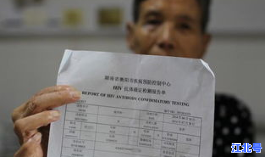 成都确诊感染源有哪些(四川成都有多少艾滋病患者)