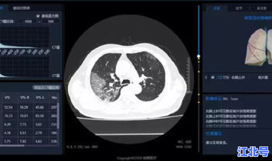 河北学生感染新冠肺炎 新型冠状病毒性肺炎症状