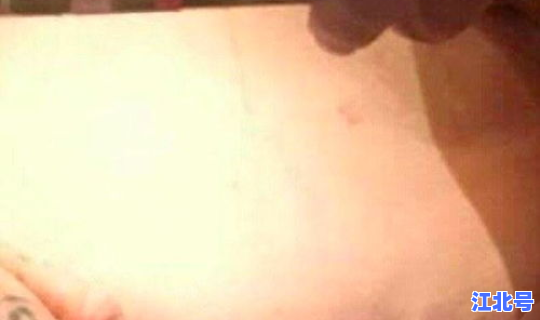 沈阳铁西区发现新冠病毒，现在有新冠病毒吗最新消息新闻